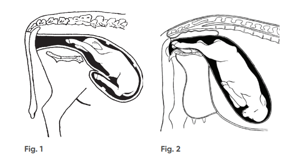 Figure 1 Normal calving position and Figure 2 posterior position