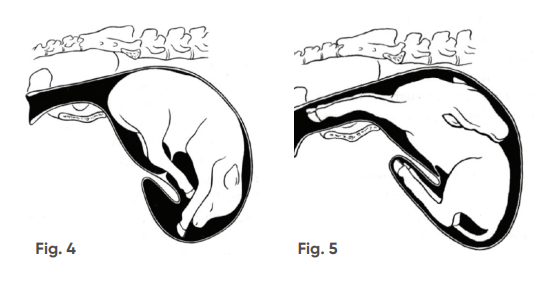 Figure 4 breech position and Figure 5 head back position 